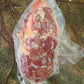 Kidney